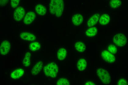 4.Antinuclear-Antibody-ANA