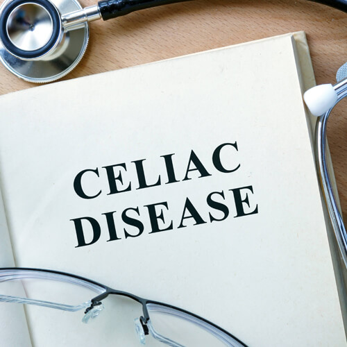 Tampa Celiac Disease A/B Screen Tests - 24/7 Labs